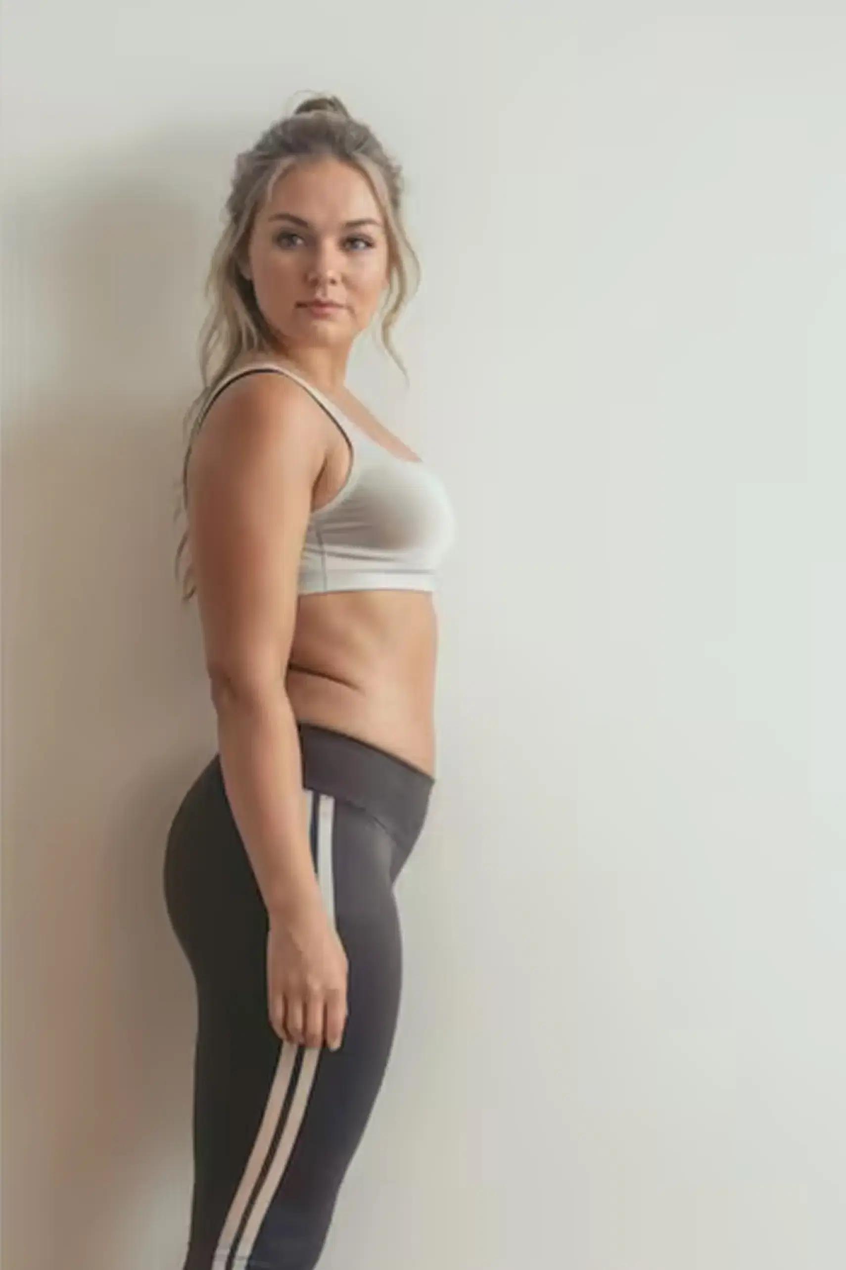 Lisa after treatment
